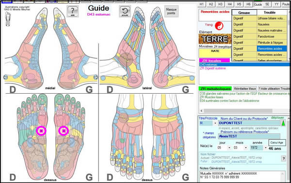 Guide des Troubles ReflexoEXPERT