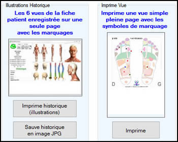 Impression ReflexoExpert